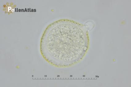 Laurus nobilis pollen secant view